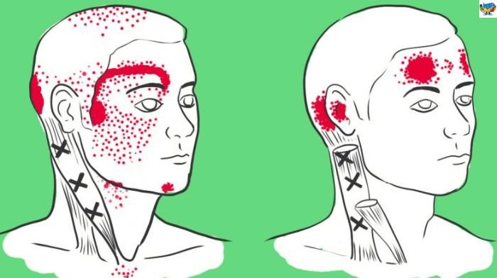 Нехватка этих продуктов вызывает головную боль. Жаль, что не знала об этом раньше! Нехватка этих продуктов вызывает головную боль. Жаль, что не знала об этом раньше!