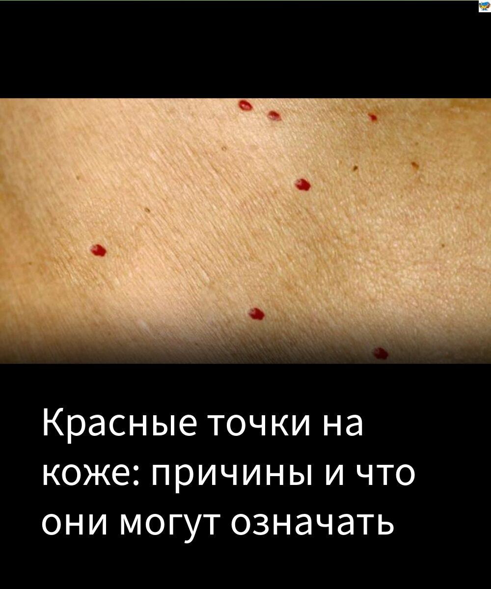 11 причин появи червоних плям на шкірі