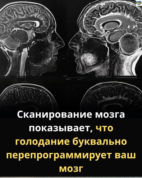 Сканування мозку показує, що голодування буквально перебудовує ваш мозок