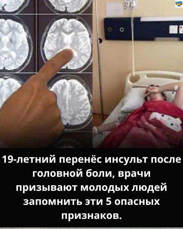 5 предупреждающих признаков инсульта у молодых взрослых